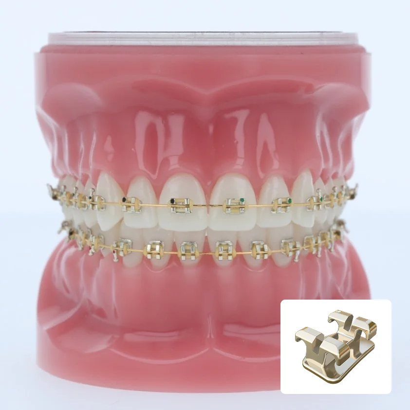 iconix-gold-braces