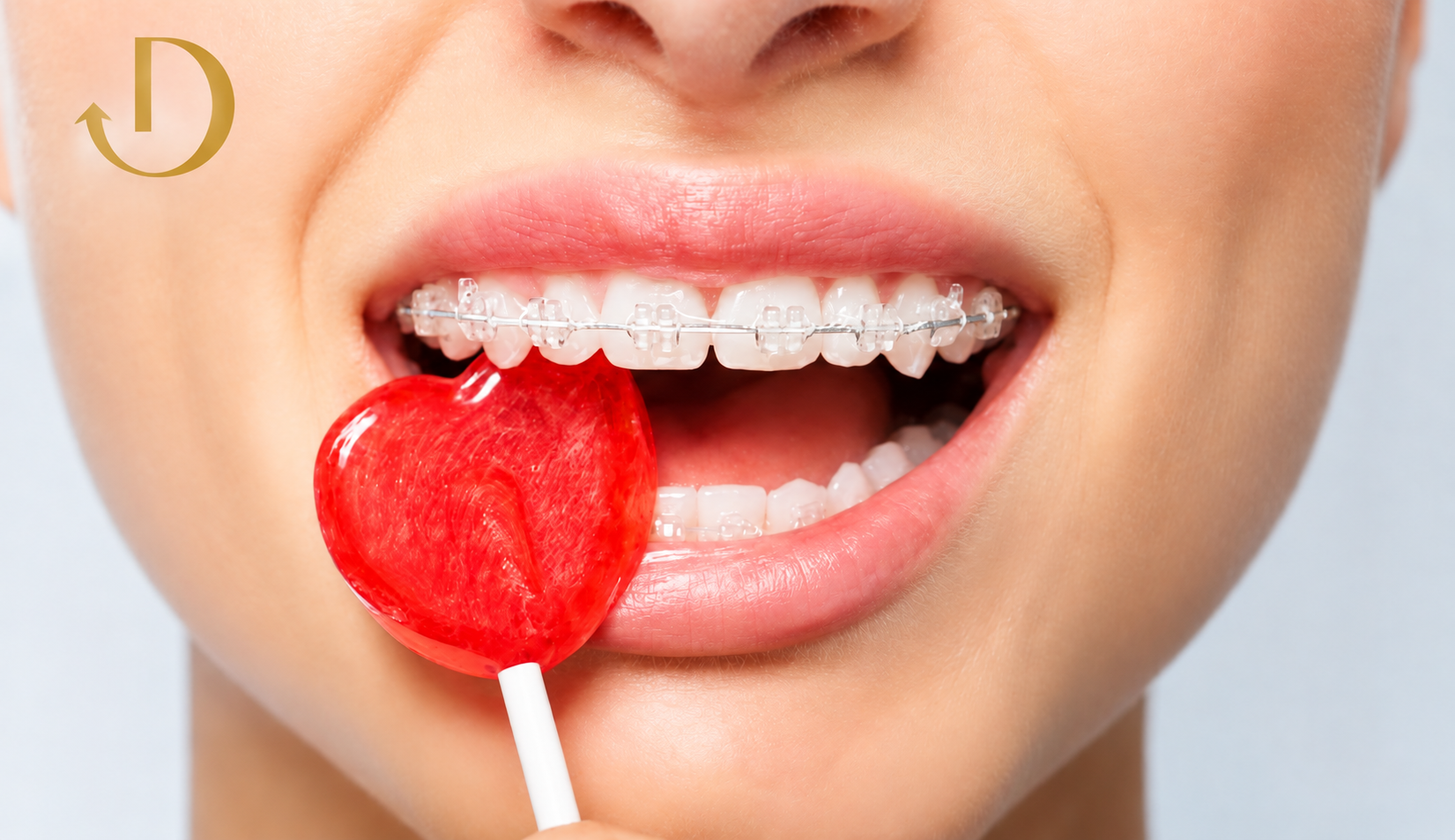 Ceramic Braces and Heart Lollipop